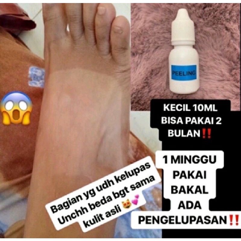 PEELING BADAN PENGELUPASAN TCA 20% Body Peeling Pemutih Pengelupas Tubuh