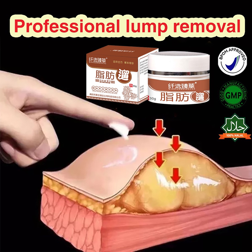 COD Obat Benjolan Lipoma Krim lipoma OBAT OLES PENGHILANG BENJOLAN LIPOMA  Obat Kista Ganglion, Obat