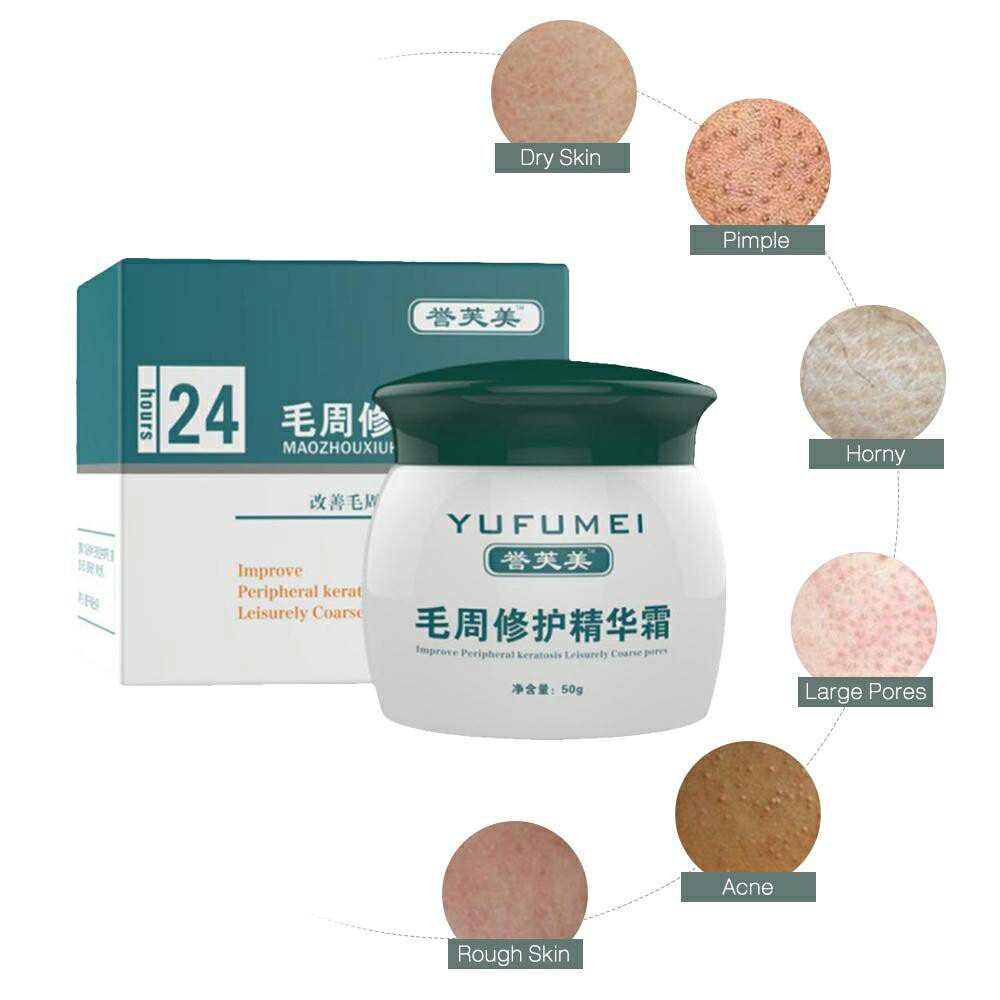 YUFUMEI face body Curing Skin kulit ayam Keratosis Skin Repair Chicken skin Pilaris acne jerawat ORI