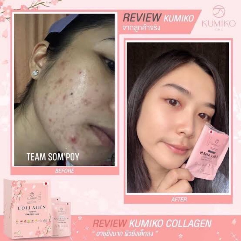kumiko collagen tripeptide minuman pemutih wajah dan badan thailand ampuh pencerah