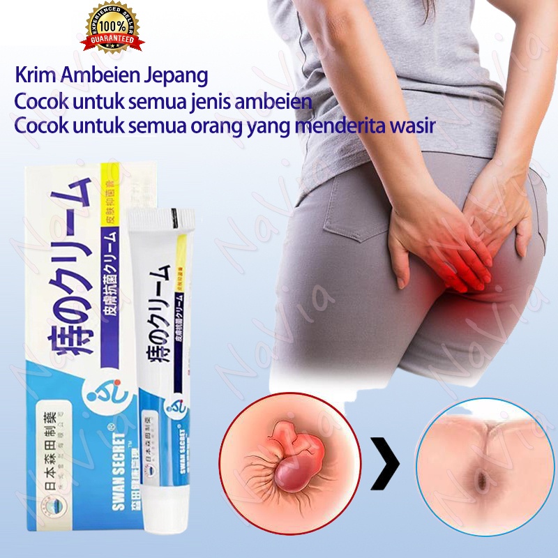 【NaVia】Krim Pemecah Wasir Eliminasi Cepat/Anal / Wasir Ambeien Bola Daging Anti Wasir Campuran Inter