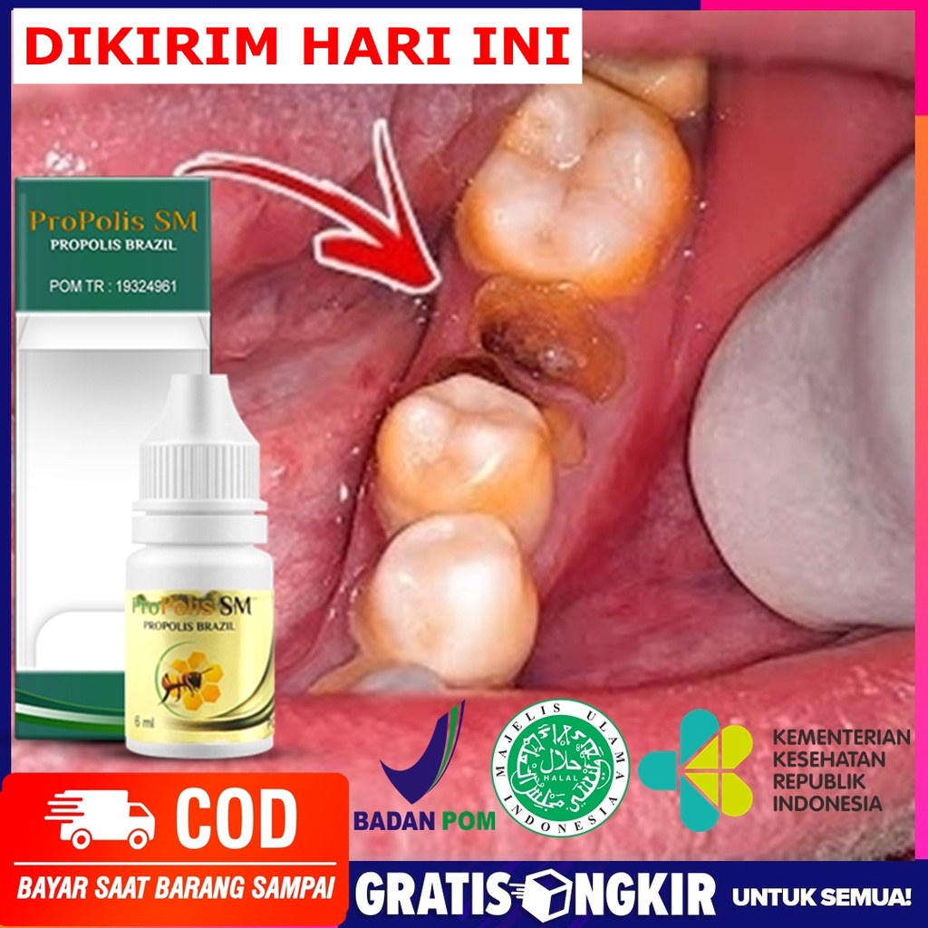 COD Obat Penghancur Gigi Berlubang, Akar Gigi,  Obat Herbal Perontok Karang Gigi, Obat Gigi Goyang, 