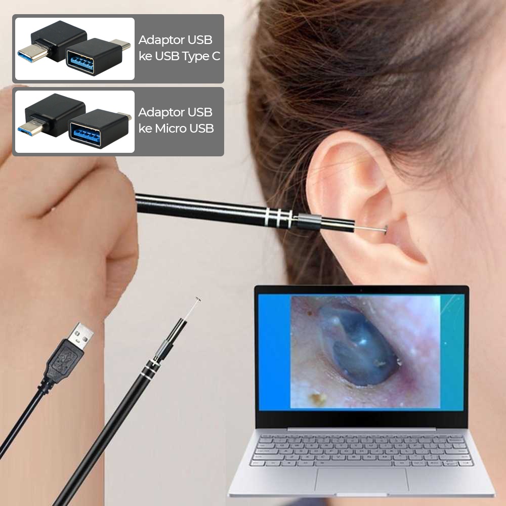 Kamera Endoskopi Pembersih Telinga HD Endoscope USB/ korek telinga/ PEMBERSIH TELINGA
