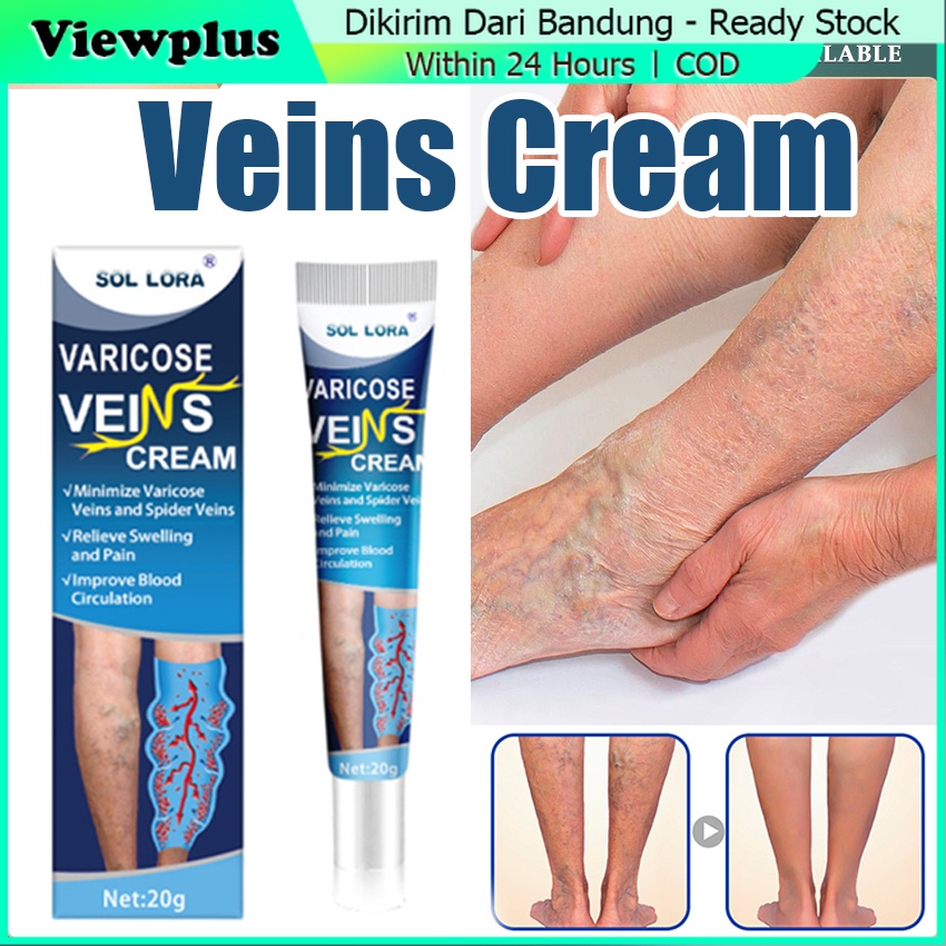 Varicose Veins Cream Obat Salep Varises Penghilang Perawatan Koyo Varises Kelamin