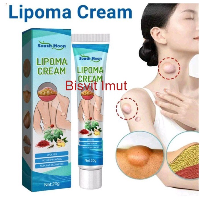 South Bulan Lipoma Removal Cream Removal Tumor Pembengkakan