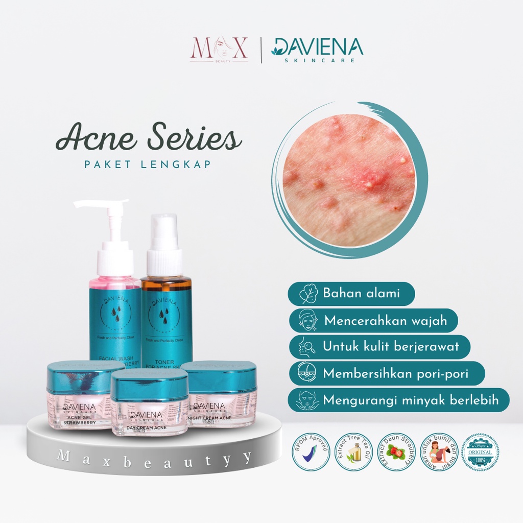 Daviena Skincare Acne Series Paket Lengkap Hemat dan Ecer