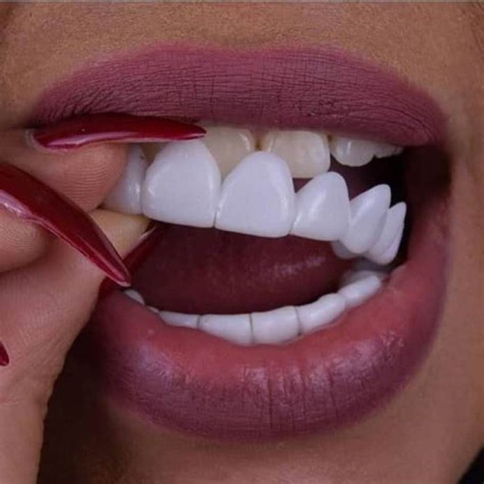 Paket Gigi Palsu Snap on Smile Pria dan Wanita Atas Bawah