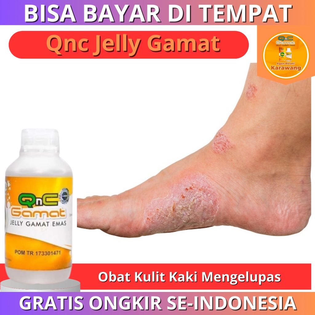 Salep Kulit Kaki Mengelupas, Salep Kaki Kering Dan Pecah, Obat Herbal Kulit Kering Pada Anak, Obat K