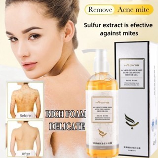 Eczema body wash 260ml Original Pengobatan Eksim psoriasis eksim kering Kurap gatal kulit jamur kuli