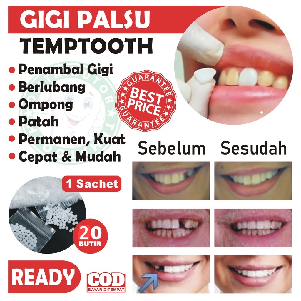 PENAMBAL GIGI BERLUBANG 20 BUTIR / TEMPTOOTH / GIGI PALSU / LEM GIGI PADAT / LEM GIGI BERLUBANG