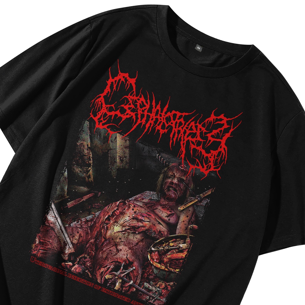 Kaos BRUTAL / SLAM / DEATH METAL  Cephalotripsy - Uterovaginal Insertion of Extirpated Anomalies Vol