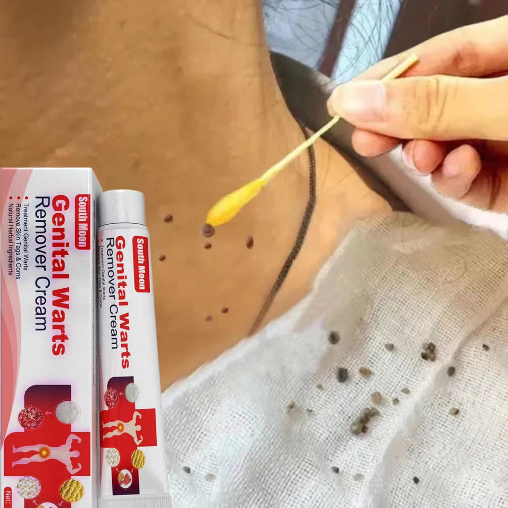 Wart Removal Cream Obat Kutil paling ampuh Oles Penghilang Kutil 20g manjur tanpa operasi mahal peng