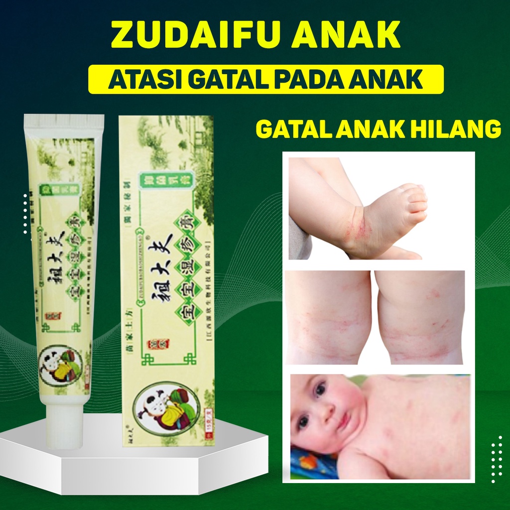 Zudaifu Anak Kecil - Salep Gatal Untuk Anak Kecil Salep Gatal Panu Kutu Air Anak