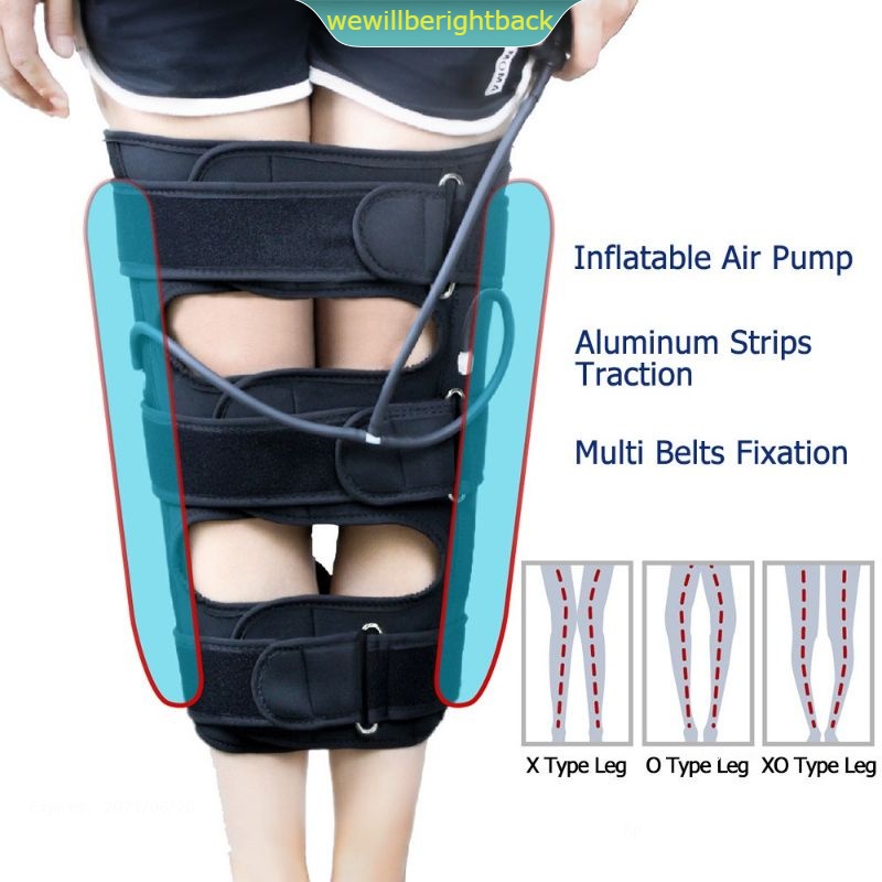 pelurus tulang kaki alat bantu terapi meluruskan kaki bentuk kaki O X leg corrector korektor kaki OX