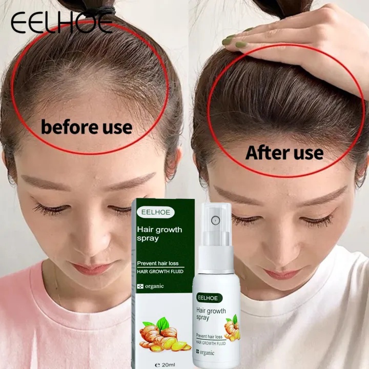 EELHOE Ginger Germinal Spray Perawatan Rambut Rontok Hair Growth Spray Pertumbuhan Rambut Untuk Pria