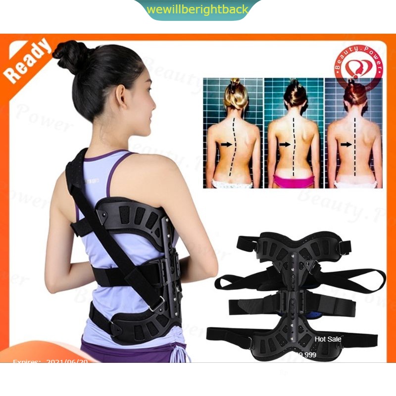 ober scoliosis pelurus tulang belakang bengkok orthosis fiksasi terapi pasca operasi skoliosis korek