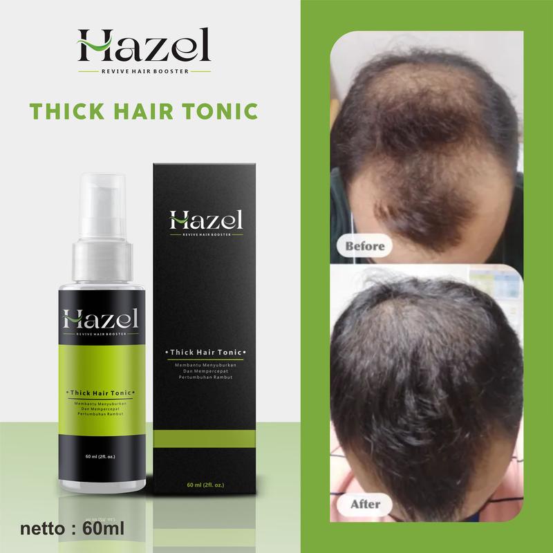 Hazel Hair Tonic Penumbuh Rambut Cepat || Penumbuh Rambut Kebotakan | Rambut Tumbuh Alami Dan Perman