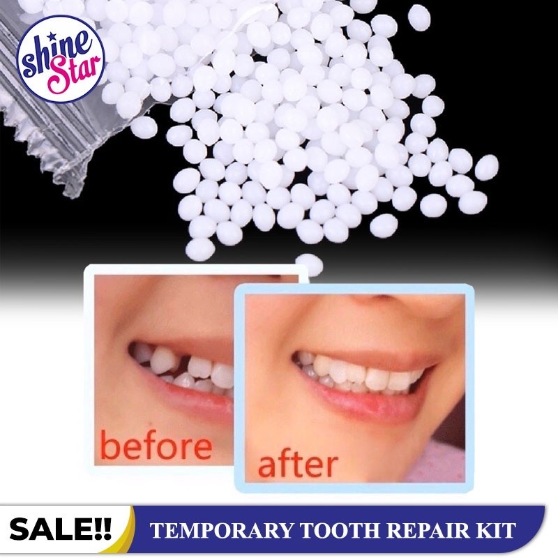 PENAMBAL GIGI BERLUBANG 100 BUTIR / TEMPTOOTH / GIGI PALSU / LEM GIGI PADAT / LEM GIGI BERLUBANG