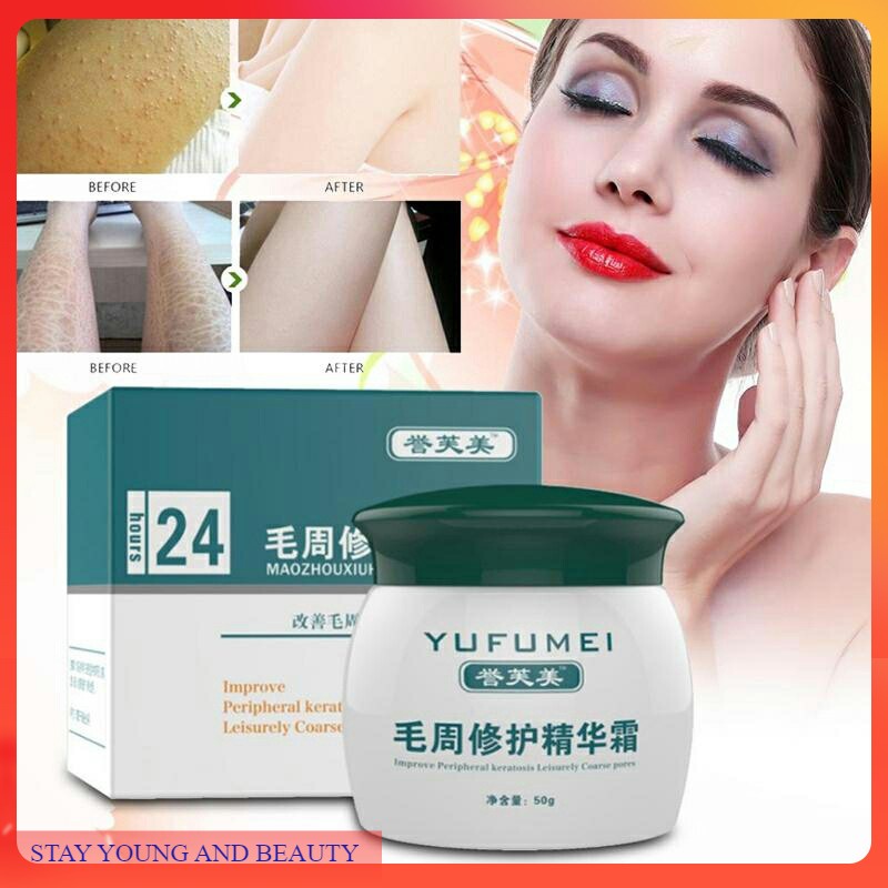 YUFUMEI face body Curing Skin kulit ayam Keratosis Skin Repair Chicken skin Pilaris acne jerawat S