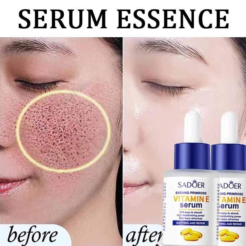 SADOER pengecil pori-pori flek pelembab dan pemutih mengecilkan vitamin E pemutih bercahaya mengecil