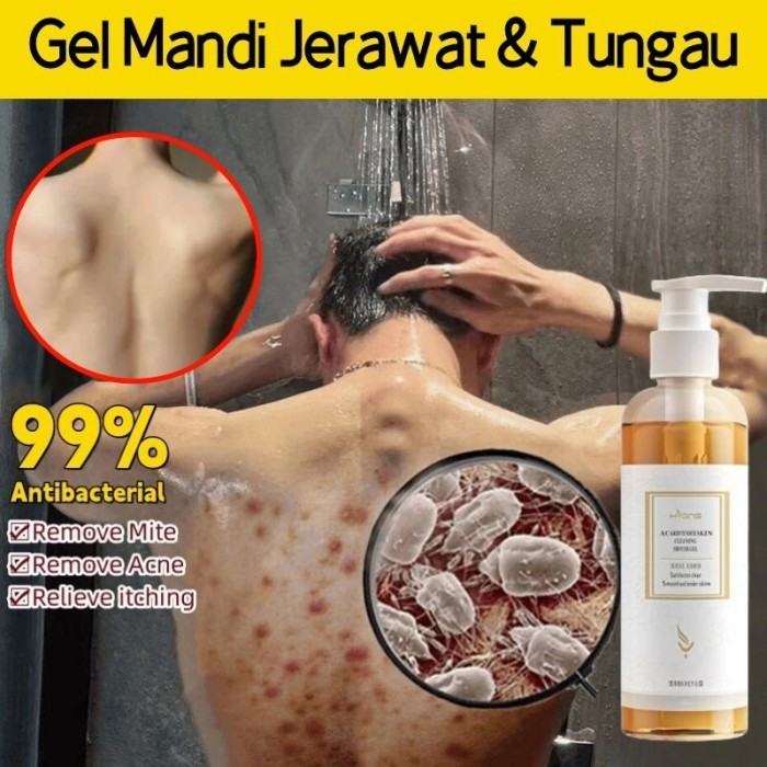 Eczema body wash 260ml Original Pengobatan Eksim psoriasis eksim kering Kurap gatal kulit jamur kuli
