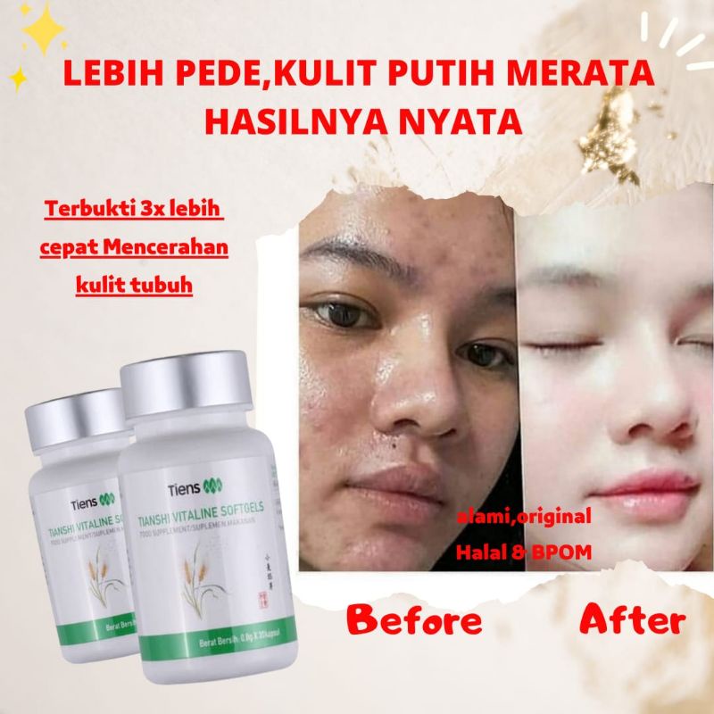 (TERLARIS)VITALINE SOFTGELS TIENS VITAGEL PEMUTIH WAJAH PEMUTIH PERMANEN KAPSUL PEMUTIH PENCERAH KUL