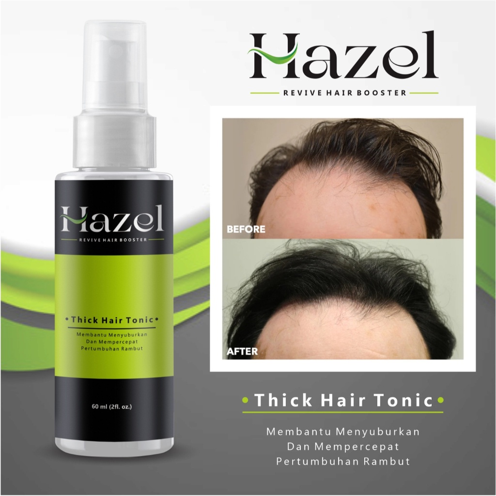 Penumbuh Rambut Kebotakan - Penumbuh Rambut Cepat | Hazel Hair Tonic Tumbuh Alami Rambut Hitam Perma