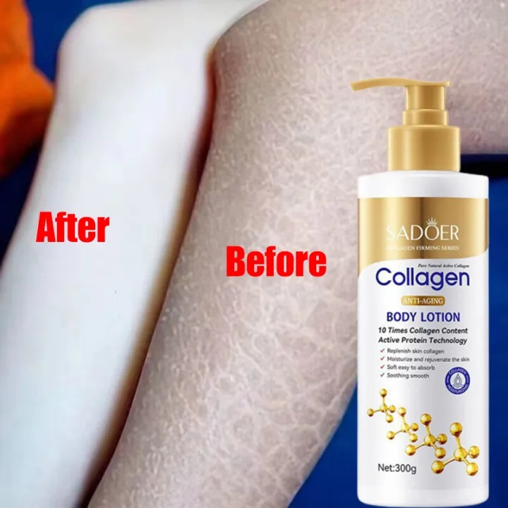 SADOER Whitening Collagen Body Lotion Pemutih Badan Permanen Bpom Whitening Body Skin Care Pelembab Dan Meremajakan Kulit Menghilangkan Kusam Kulit Mencerahkan Warna Kulit 300ML