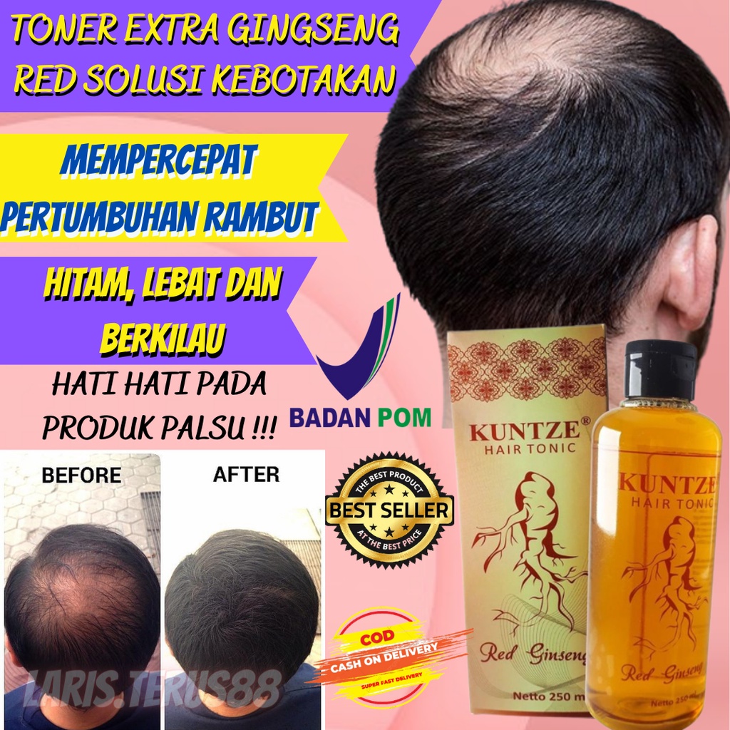 HAIR TONIC RED GINSENG 250ML KUNTZE BPOM PENUMBUH RAMBUT VITAMIN RAMBUT TREATMENT RAMBUT HAIR CARE T