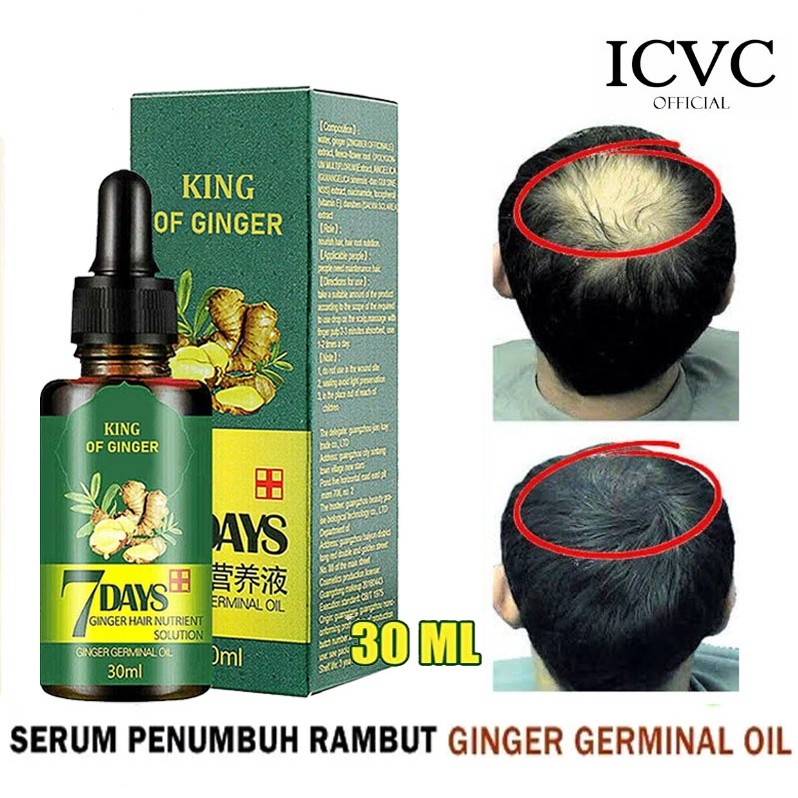 Serum 7 days ginger germinal rambut botak / Serum Penumbuh Rambu