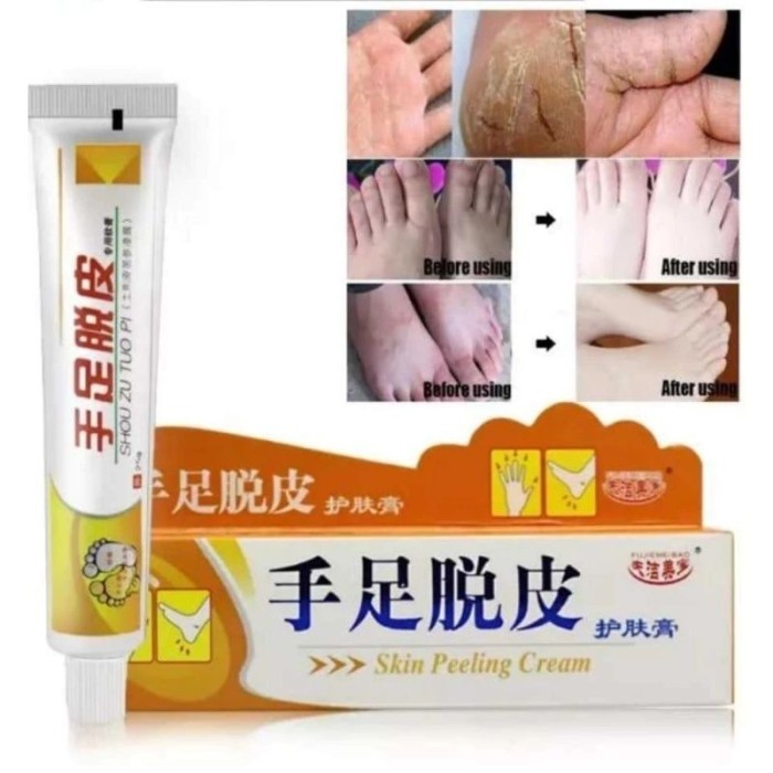 SALEP HUATUO KULIT KERING PECAH PECAH KAPALAN Shou zu tuo pi skin peeling cream Melembabkan kulit ke