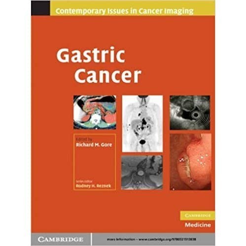 

100 Q&A About Gastric Cancer (100 Questions & Answers about . . .) (