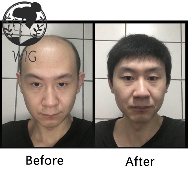 rambut palsu pria Tersedia Wig untuk Pendek Pria Wig Rambut Bagian Kepala Pengganti Blok Bernapas Da