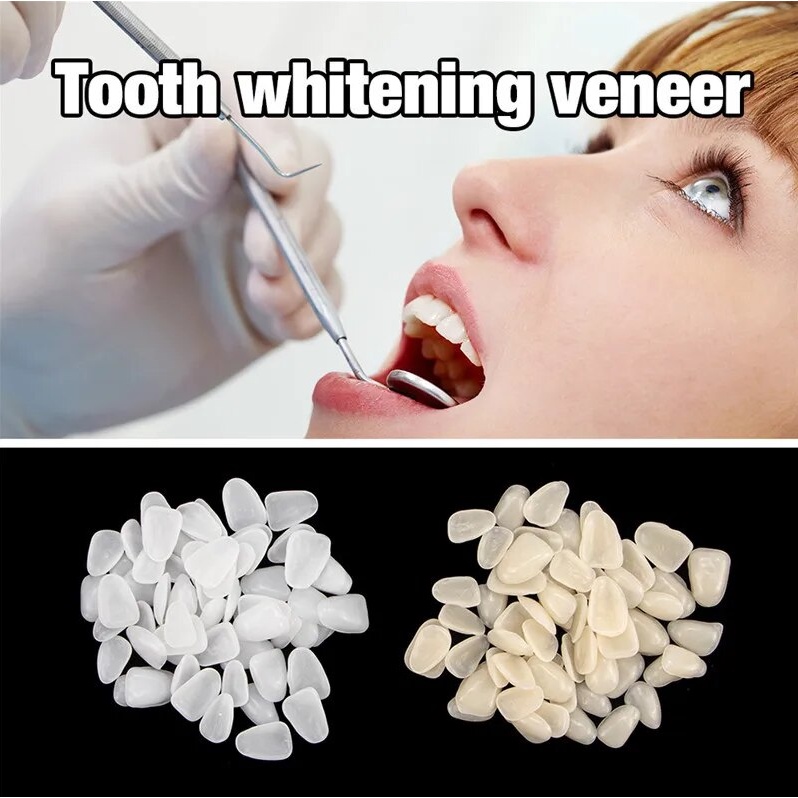 Dental Crown Gigi Anterior Veneer Temporary isi 50 A1 dan A2