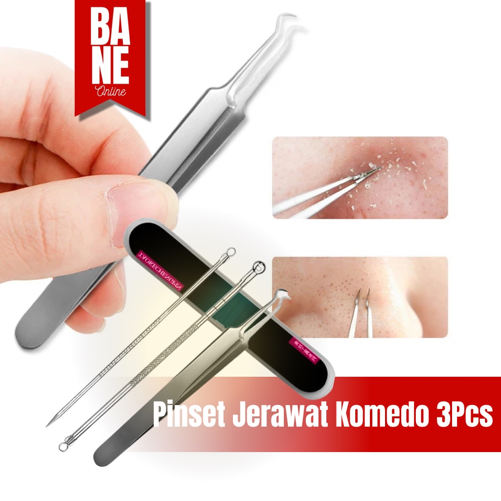 Pinset Komedo Penjepit Komedo Alat Perawatan Wajah Penghilang Jerawat Komedo