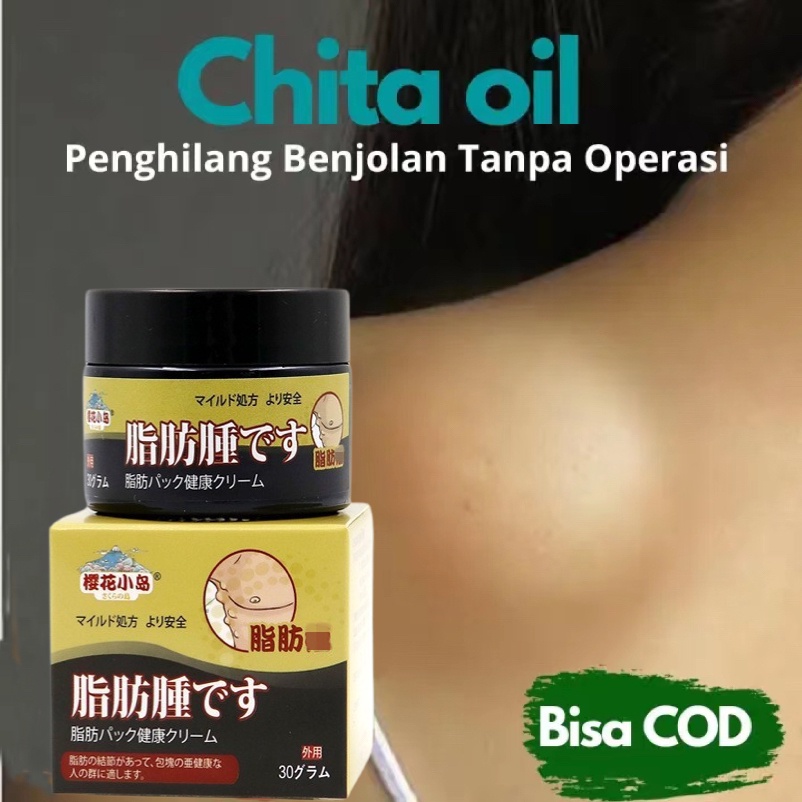 Lipoma Cream/Obat Benjolan Lipoma/Obat Benjolan Di/Tubuh/Benjolan Di Leher Kepala Payudara