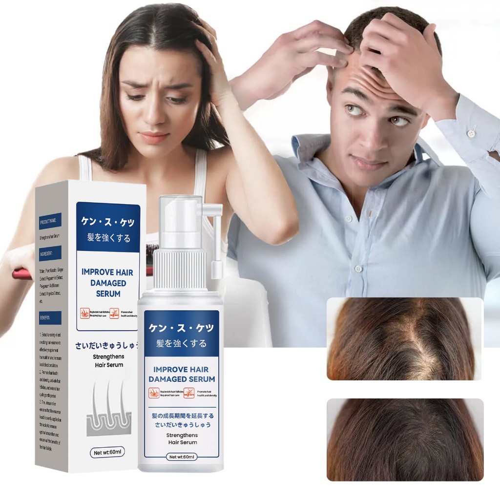 Jaysuing Serum Rambut Kental Penumbuh Rambut Botak Mencegah Kerontokkan Anti Rambut Rontok Kerusakan