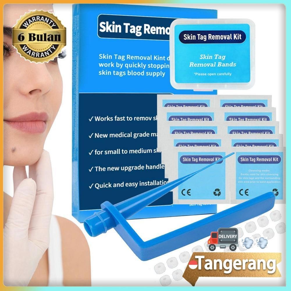 Skin Tag Removal Kit / Skin Tag Remover / Wart Remover / Wart Removal Kit Obat Kutil Penghilang