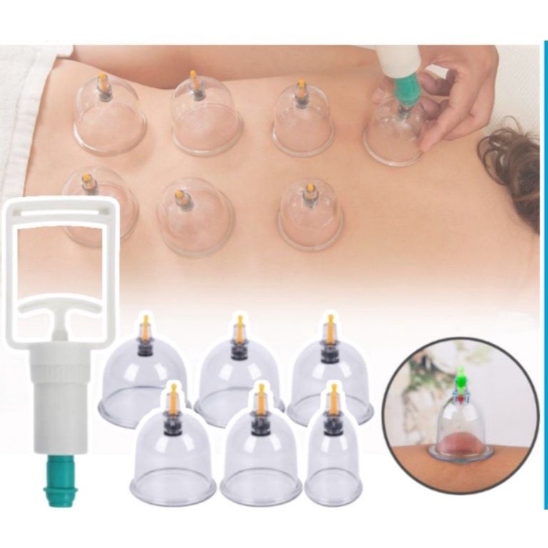 ALAT BEKAM KOP ANGIN ISI 6 / ALAT KOP KESEHATAN / ALAT MASUK ANGIN original