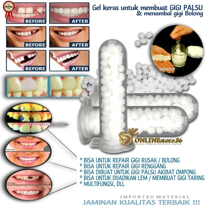 Gigi Palsu Temptooth Temporary tooth | Lem Tambal Gigi Instan Kuat A