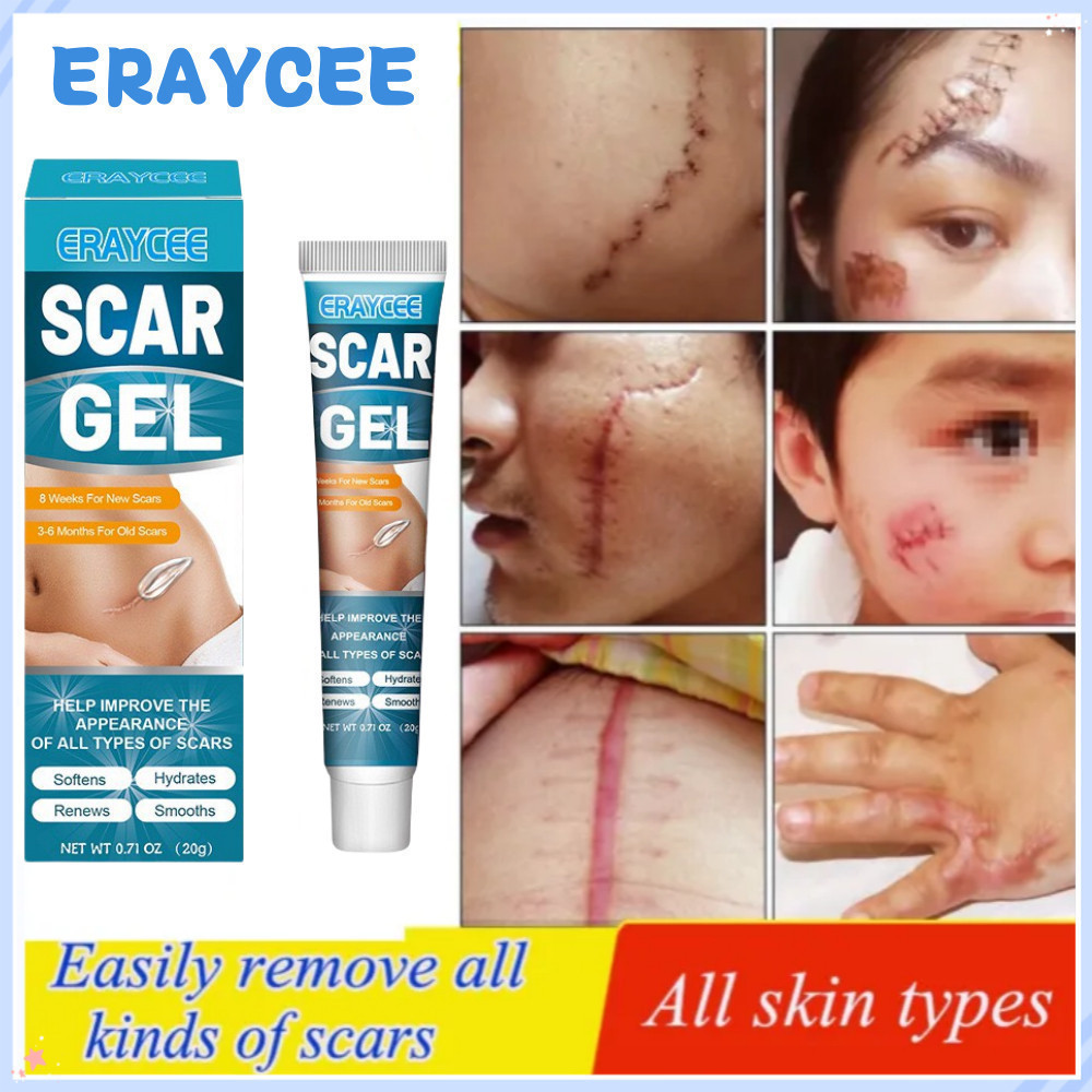 Scar Removal Cream scar care bekas luka Obat penghilang bekas luka Salep bekas gigitan nyamuk bekas 