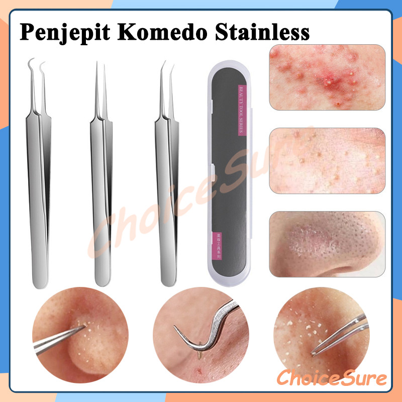 Penjepit Komedo Stainless Besar / Pinset Jepit Komedo Jerawat / Alat Capit Untuk Menghilangkan Komed