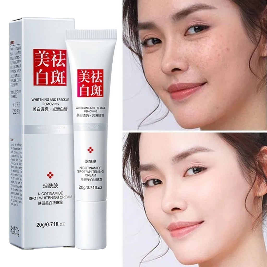 Krim EBUG Whitening and Freckle Removal Cream Penghilang Flek Bintik Hitam Pemutih Wajah Glowing