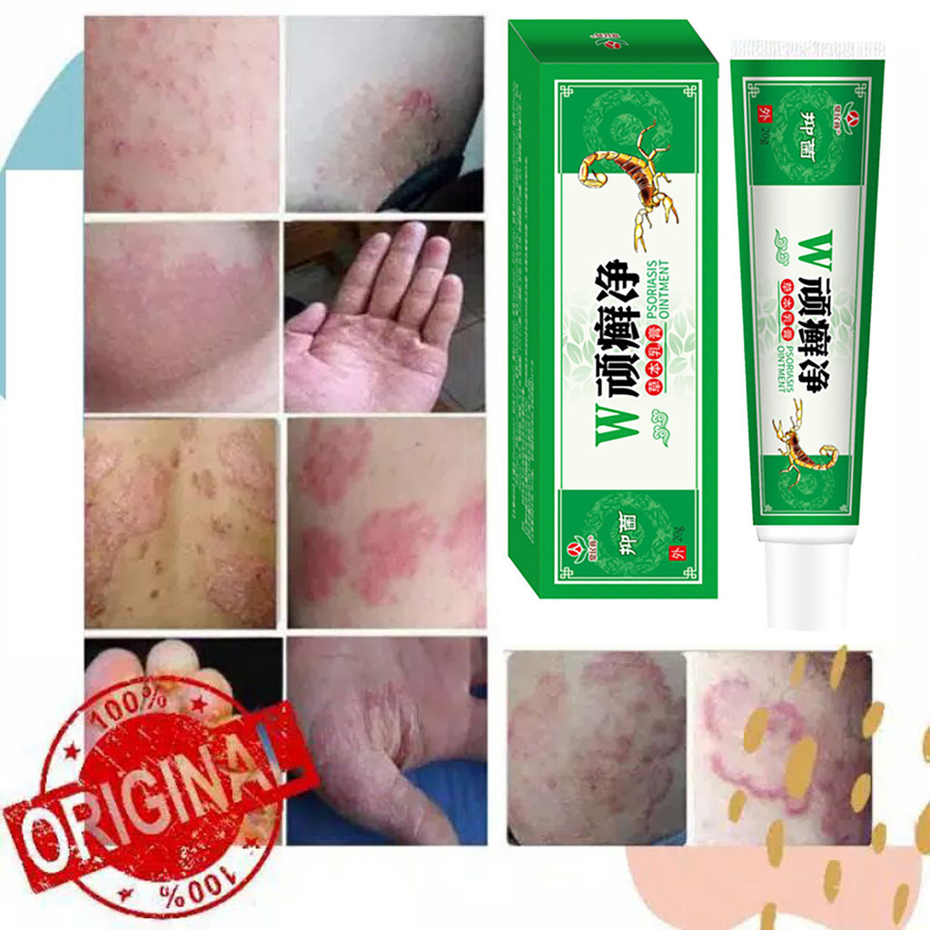 Scabies Manusia Kudis Herpes Kulit  SeluruhGatal Salep obat kulit gatal Gatal - Obat Gatal Selangkan