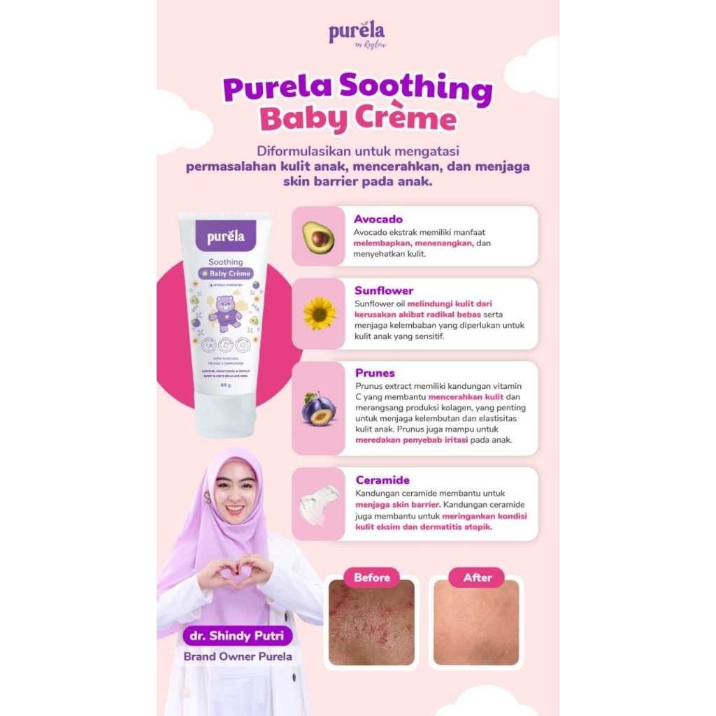 Purela Soothing Baby Creme Atasi Iritasi Ruam Beruntusan Kulit Kemerahan