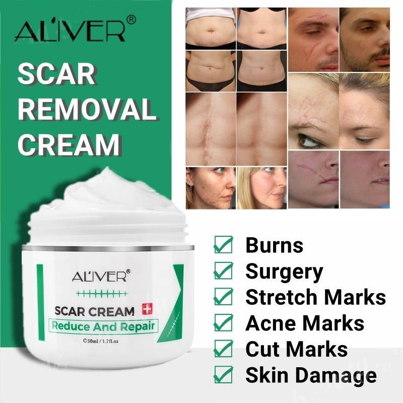 ALIVER Scar Cream Removal Krim Penghilang scar keloid bopeng bekas luka lama dan baru