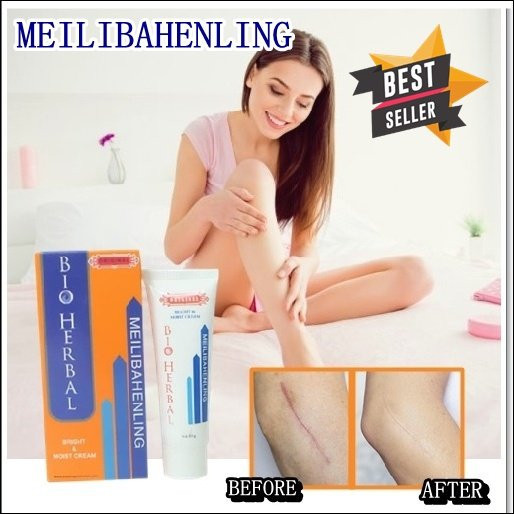 Meilibahenling Bio Herbal Penhilang Bekas Luka Keloid Jerawat Keloid