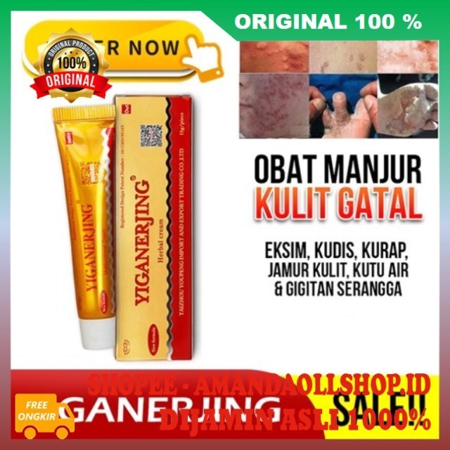 Salep Herbal Yiganerjing Psoriasis Dermatis Obat Gatal Kulit Eksim 100% ASLI