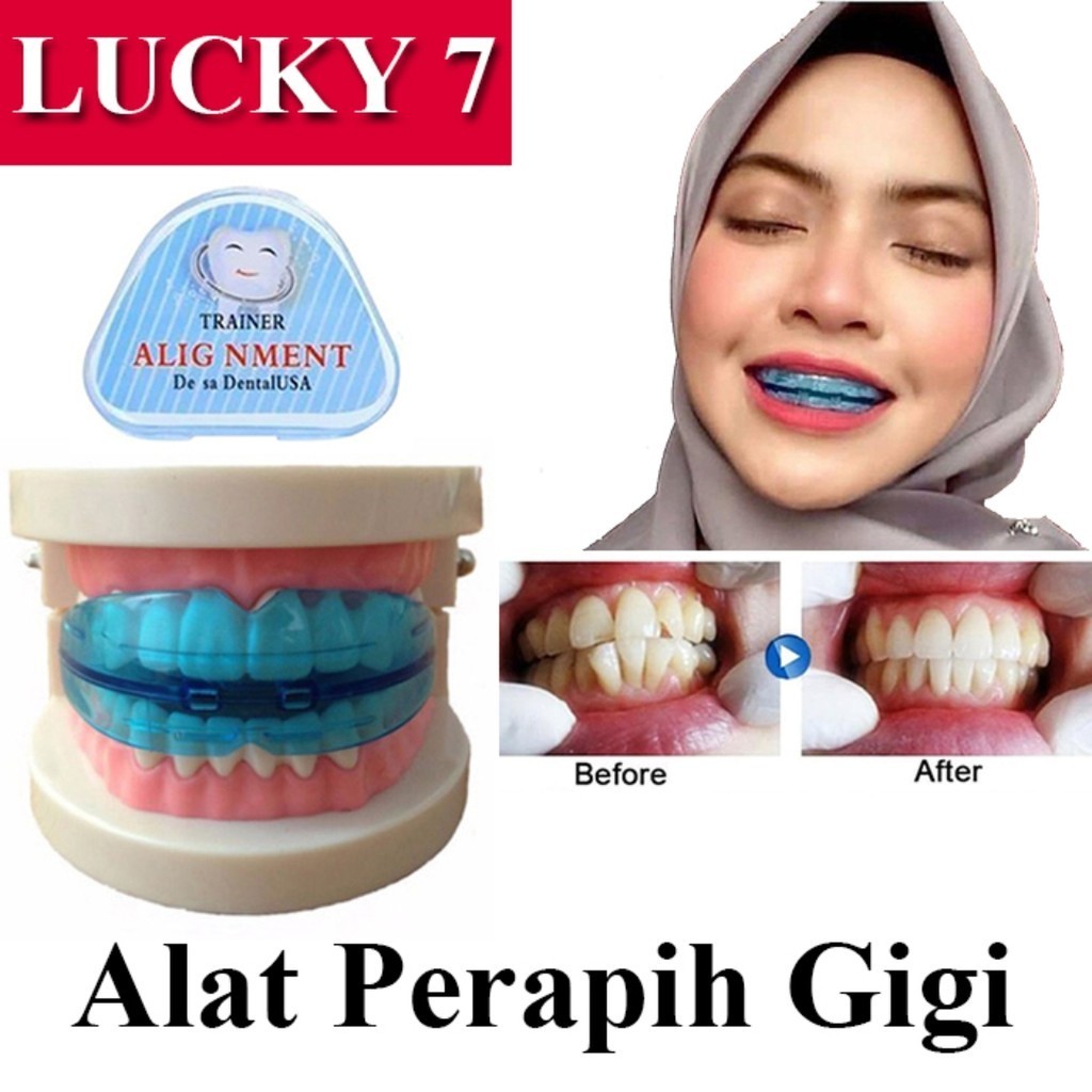 Alat Perapih Gigi Tonggos / Teeth Trainer Alignment - Ori Behel Lepas Pasang - Alat Pelurus Gigi Per