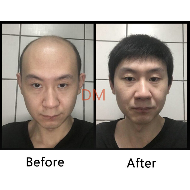 【Kiriman hari yang sama】 rambut palsu pria Tersedia Wig untuk Pendek Pria Wig Rambut Bagian Kepala P